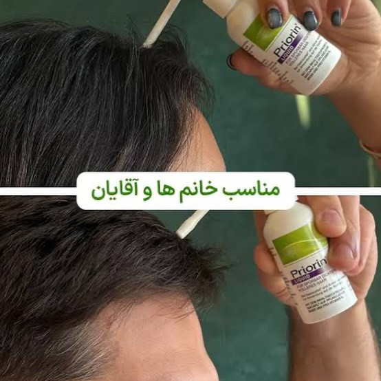 سرم ضد ریزش و تقویت کننده مو پریورین بایر اورجینال Priorin L